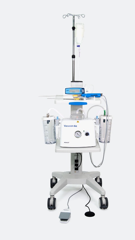 LipoCart — Sustav za motornu liposukciju